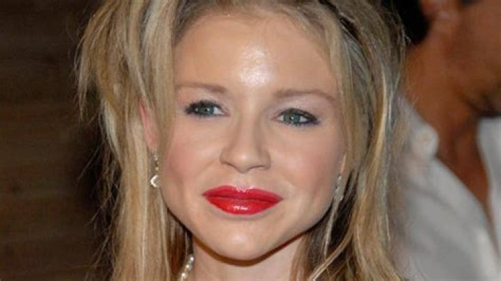 Casey Johnson died from diabetes, not drugs or suicide